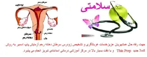 پاپ اسمیر