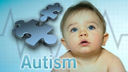 شروع بکار مرکز اوتیسم 